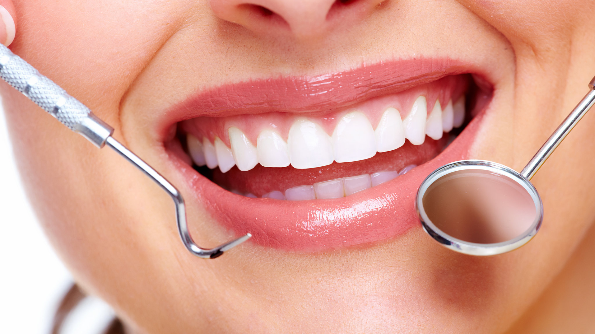 How to Ensure Lasting Results from Teeth Whitening in Dubai?