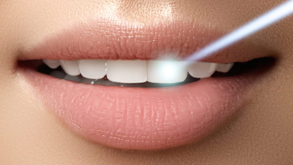 Understanding Laser Contouring